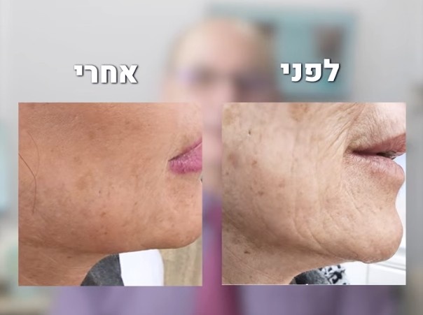 פרסומת פוש 1