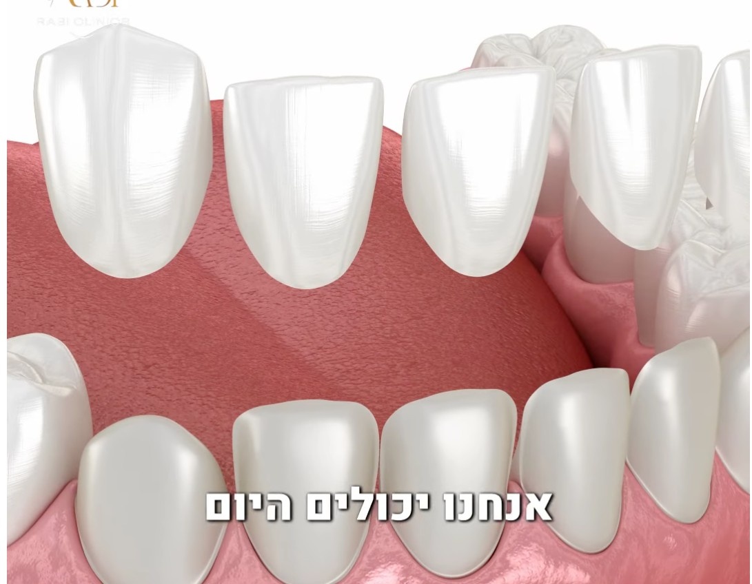 פרסומת פוש 1
